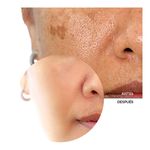 SERUM x30 B77 resurfacing SKINTREATS REVOX