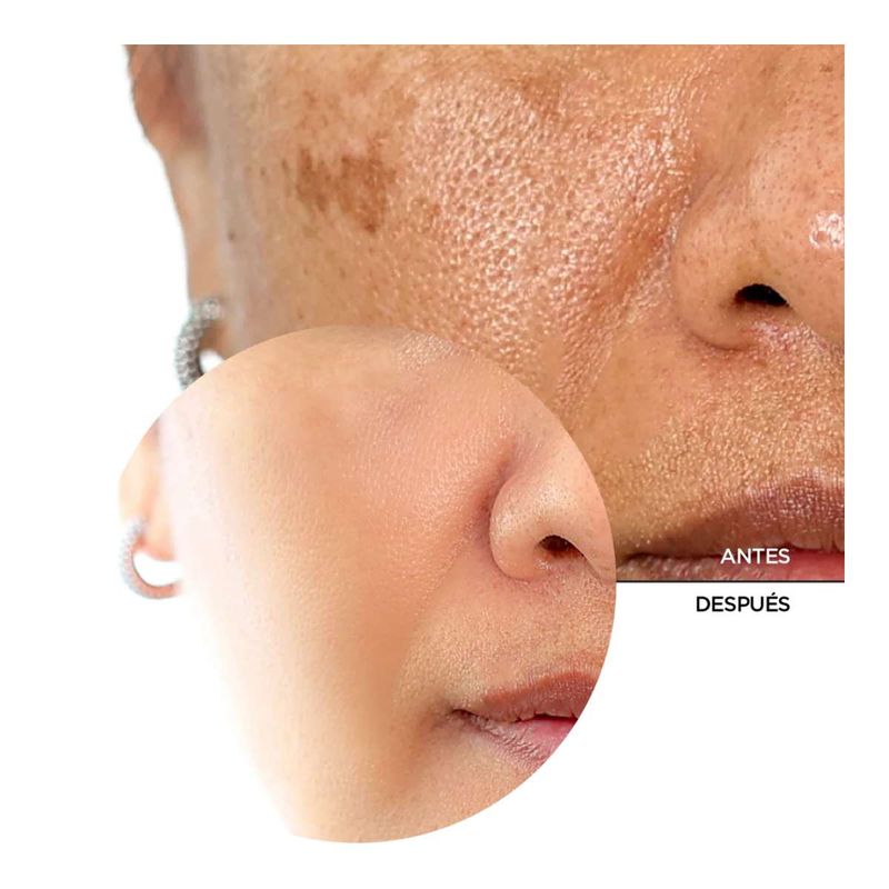 SERUM x30 B77 resurfacing SKINTREATS REVOX