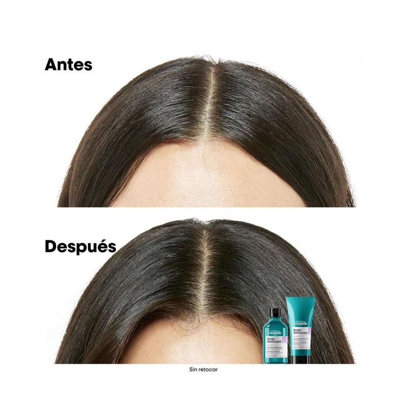 SH X300 SCALP Anti Inconfort EXPERT