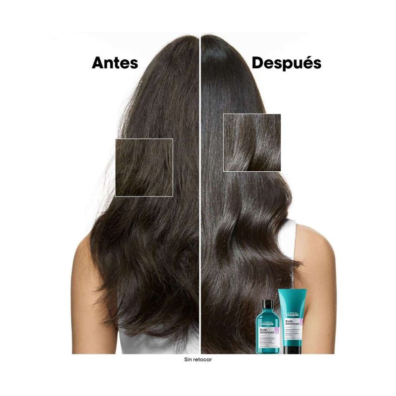 SH X300 SCALP Anti Inconfort EXPERT