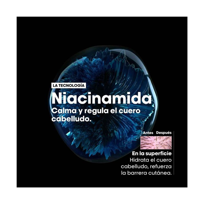 SH X300 SCALP Anti Inconfort EXPERT