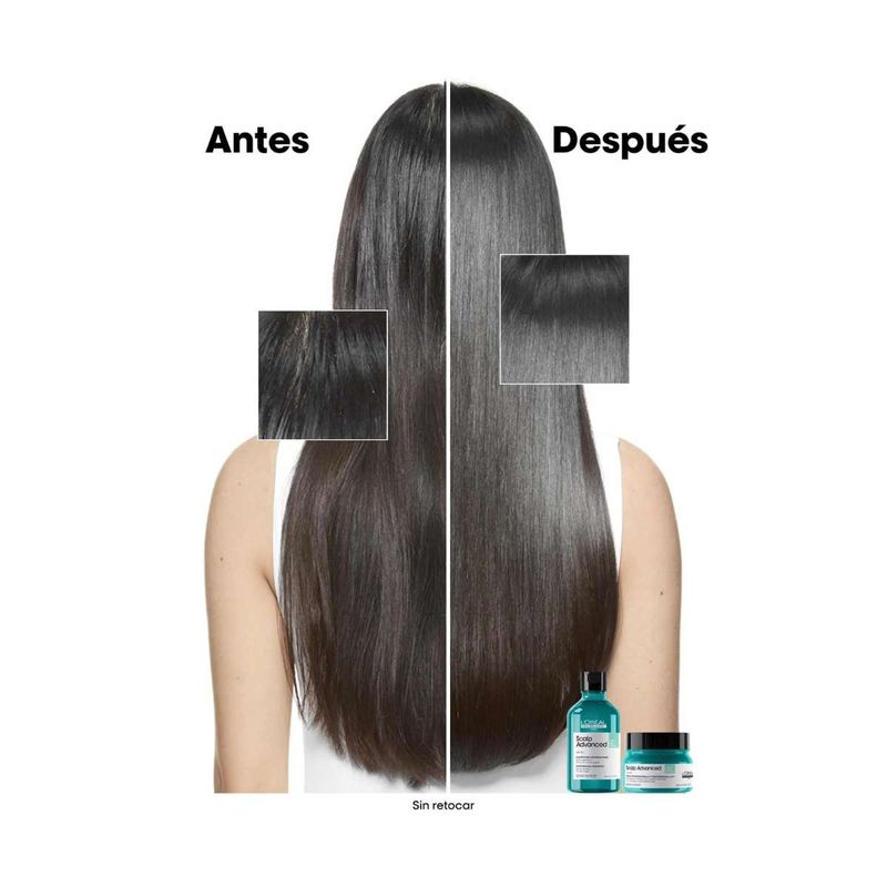 TRAT X250 SCALP Anti Gras EXPERT