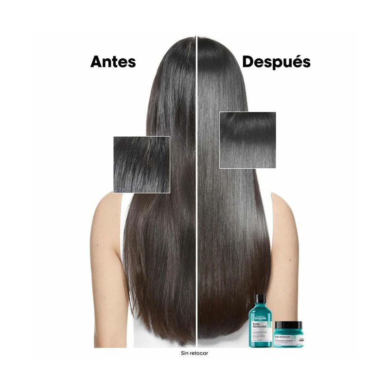 SH X300 SCALP Anti Gras EXPERT