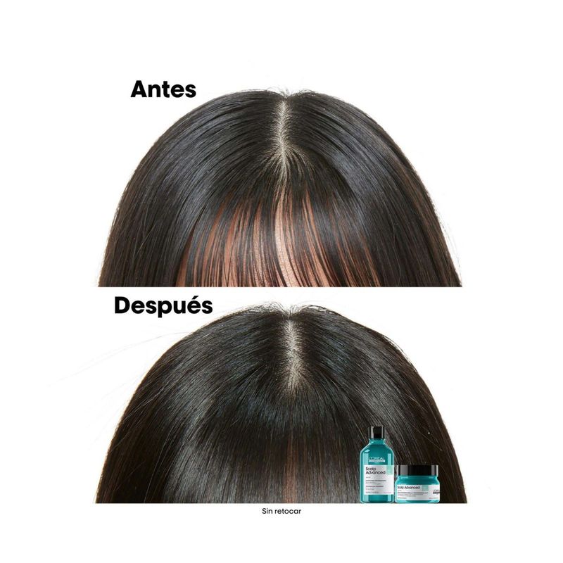 SH X300 SCALP Anti Gras EXPERT