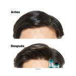 SH X300 SCALP Anti Gras EXPERT